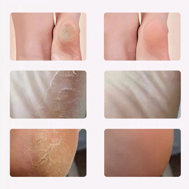 Scrubber elettrico per piedi per una pelle liscia e sana