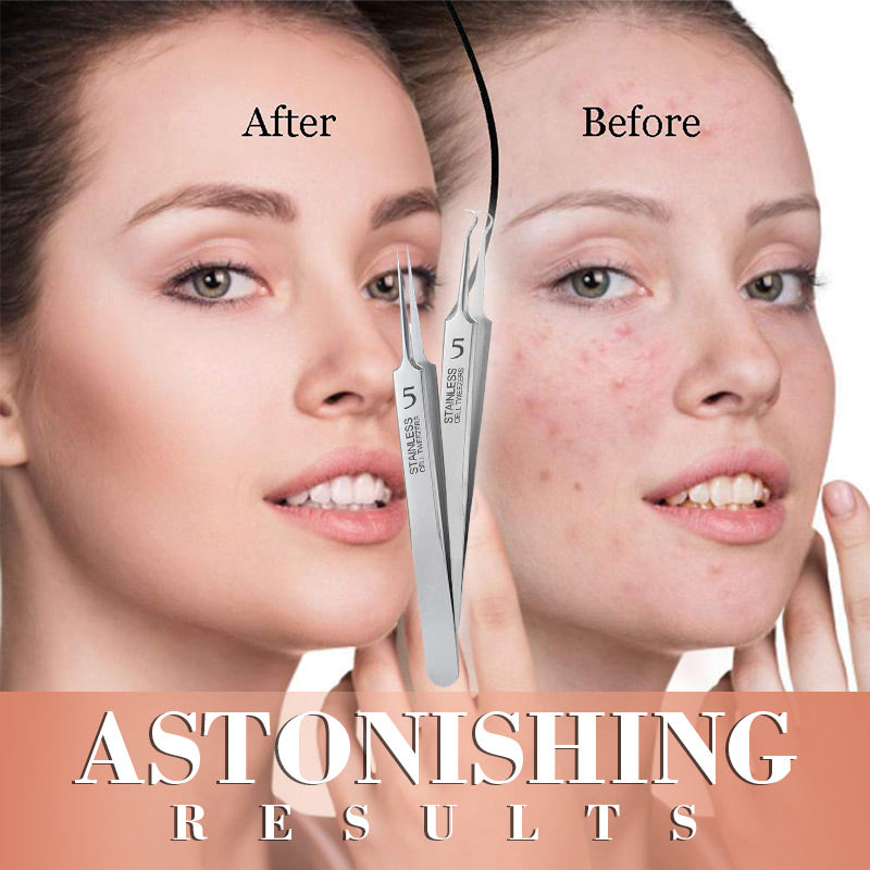 Pinzette specializzate per centri estetici