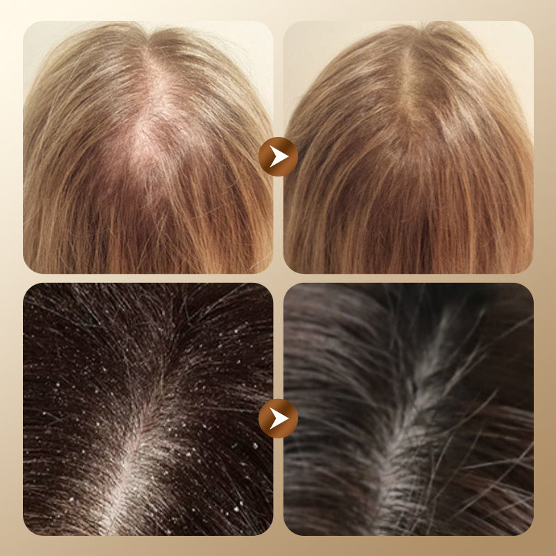 Shampoo alle erbe contro la caduta dei capelli e per la crescita dei capelli